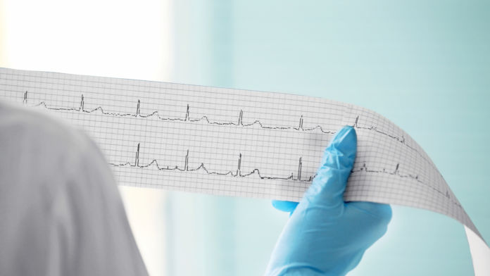  cardiology "title =" cardiology "/> </div>
<ul>
<li><strong> یک متخصص قلب و عروق اپل را به نقض حق ثبت اختراع خود از طریق معرفی برنامه ECG برای ساعت خود متهم می کند. </strong></li>
<li><strong> این مرد خواستار محاکمه توسط هیئت منصفه و تأیید درخواست وی برای جبران خسارت. </strong></li>
<li><strong> اپل در مورد این پرونده اظهار نظری نکرده است ، و قرار است این پرونده بسیار پیچیده و چند لایه باشد. </strong></li>
</ul>
<p> یک متخصص قلب و عروق مستقر در نیویورک به نام جوزف ویزل پرونده ای علیه اپل تشکیل داد شرکت با ادعا که ساعت غول فناوری از اختراع اختراع نظارت بر ضربان قلب خود استفاده می کند ، پزشک اکنون از دادگاه می خواهد تا تأیید جبران خسارت سنگین را در نظر بگیرد ، زیرا ادعا می کند اپل از سپتامبر 2017 پیام های خود را نادیده گرفته است. قبلاً با مذاکره با متخصص قلب و عروق پذیرفت ، وی تصمیم گرفت که پر کردن دادخواست اکنون تنها گزینه باقیمانده است. </p>
<p> از آنجا که می توانیم پیدا کنیم ، آقای ویزل مجموعه ای از حق ثبت اختراع را ارائه داده است که مربوط به تشخیص آریتمی ضربان قلب ، قدیمی ترین آنها است. ساعت (2006) به شماره US20060195037A1 شماره گذاری شده است ، که توصیف <em> "روش و دستگاهی برای تعیین فیبریلاسیون دهلیزی احتمالی یا عدم وجود فیبریلاسیون دهلیزی است که شامل تشخیص ریتم پالس از پشت سر هم از فواصل زمانی است که هر مربوط به فاصله مربوطه بین پی در پی ضربان نبض. "</em> </p>
<p> برای کسانی که اخبار فنی را از نزدیک دنبال نکرده اند ، اپل watchOS تقریباً یک سال پیش یک برنامه جدید جدید ECG (الکتروکاردیوگرام) را ارائه داد ، که شامل ریتم قلب ، ریتم سینوس و هشدارها بود. خطرات بالقوه از فیبریلاسیون دهلیزی – سایپرز ، باشگاه دانش این همه به نظر می رسد بسیار شبیه به آنچه در حق ثبت اختراع Wiesel شرح داده شده است ، می باشد و بنابراین این سؤال پیش می آید كه آیا اپل حق ثبت اختراع این مرد را نقض كرده است یا نه. این تصمیم توسط دادگاه فدرال بروكلین ، كه در آن محل دعوی است ، اتخاذ خواهد شد. </p>
<p> ساعت های اپل با اطلاع رسانی آنها از ضربان قلب نامنظم كه نشانگر اضطراری است ، صدها نفر را نجات داده اند. بنابراین ، پزشک از غول فناوری درخواست نمی کند که برنامه ECG خود را حذف کند ، بلکه به دلیل ادعای استفاده از فناوری خود ، به او غرامت عادلانه پرداخت می کند. همانطور که ادعا می کند ، اپل با آگاهی و درک حقوق خود را نقض می کند ، زیرا آنها از الگوی طبیعی و غیر طبیعی پزشک برای تعیین ضربان قلب منظم استفاده می کنند و چه مواردی را غیر منظم می دانند. </p>
<p> اپل از ارائه اظهارنظر رسمی در این باره خودداری کرد. دادگاه به طور حتم دشوار است. این شرکت می تواند ادعا کند که آنها در طی چرخه های گسترده آزمایش و توسعه خود با سایر متخصصان قلب و عروق مشورت کرده اند و با توجه به زمینه عملکرد مشترک قلب که زیربنای همه انسان ها است ، رسیدن به آنها به همان سیستم های نتیجه گیری طبیعی طبیعی خواهد بود. علاوه بر این ، دادگاه موظف است اثرات مفیدی را که برنامه ECG و با تمدید محصول در جامعه دارد ، در نظر بگیرد. با توجه به موفقیت عظیم بازار اپل واچ و نقش اساسی که عملکرد ECG در آن بازی می کند ، آقای ویزل می تواند جبران خسارت بزرگی دریافت کند. </p>
<p> <em> به نظر شما در این مبارزه قانونی چه اتفاقی می افتد؟ پیش بینی های خود را با ما در بخش نظرات در زیر ، یا در انجمن های اجتماعی ما ، در فیس بوک و <a href=